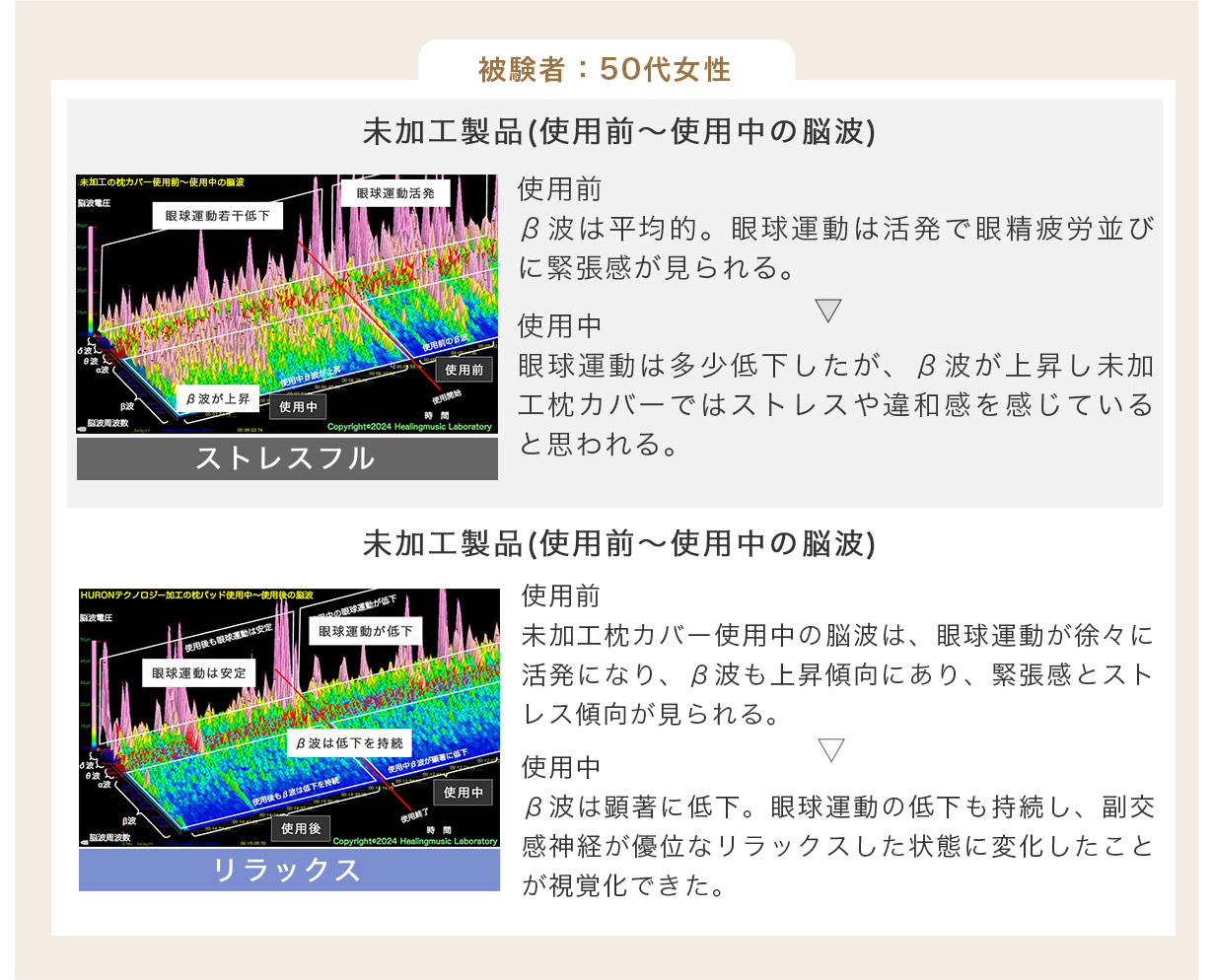 50代女性脳波測定結果